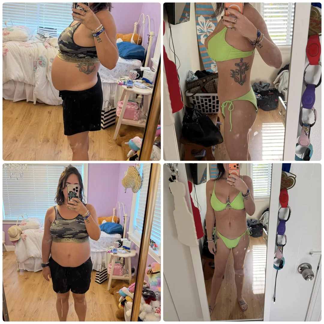 Retatrutide peptide buy UK — Rachel T before after 4 months