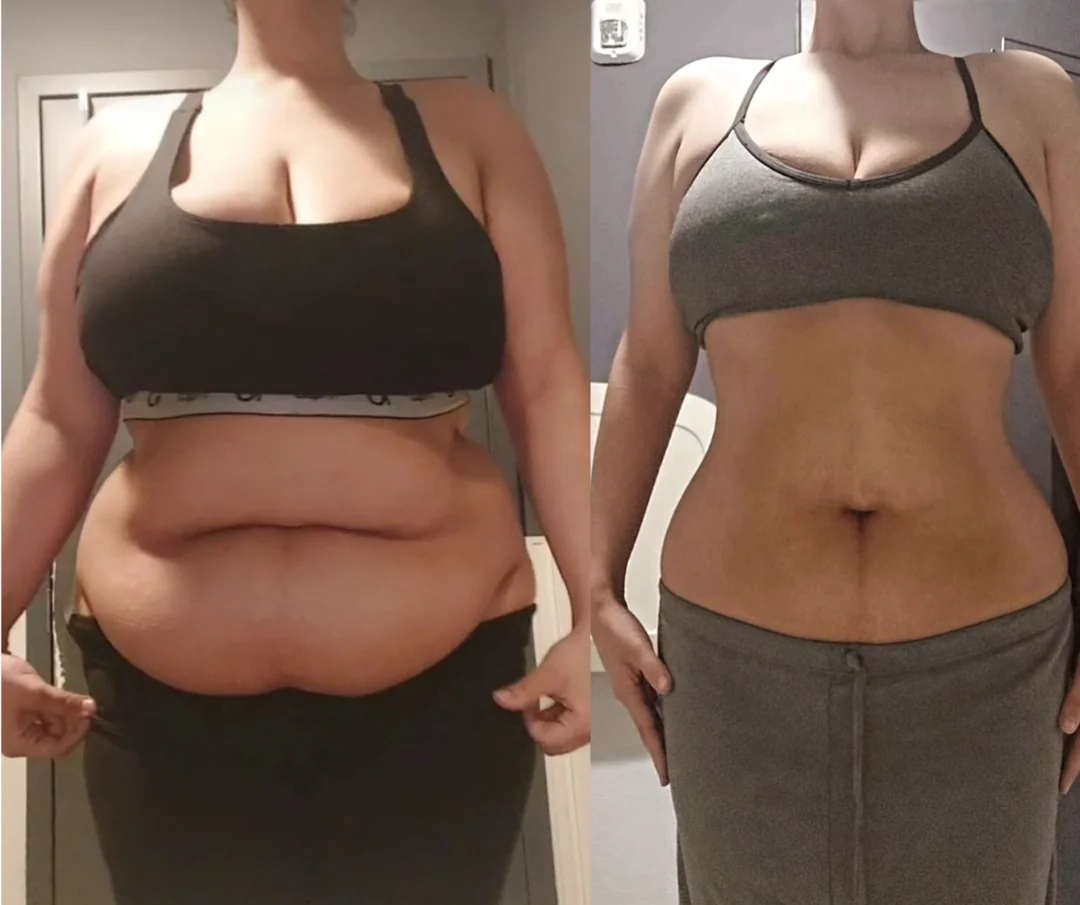 Retatrutide peptide buy — Sarah M UK buyer before and after 2 months
